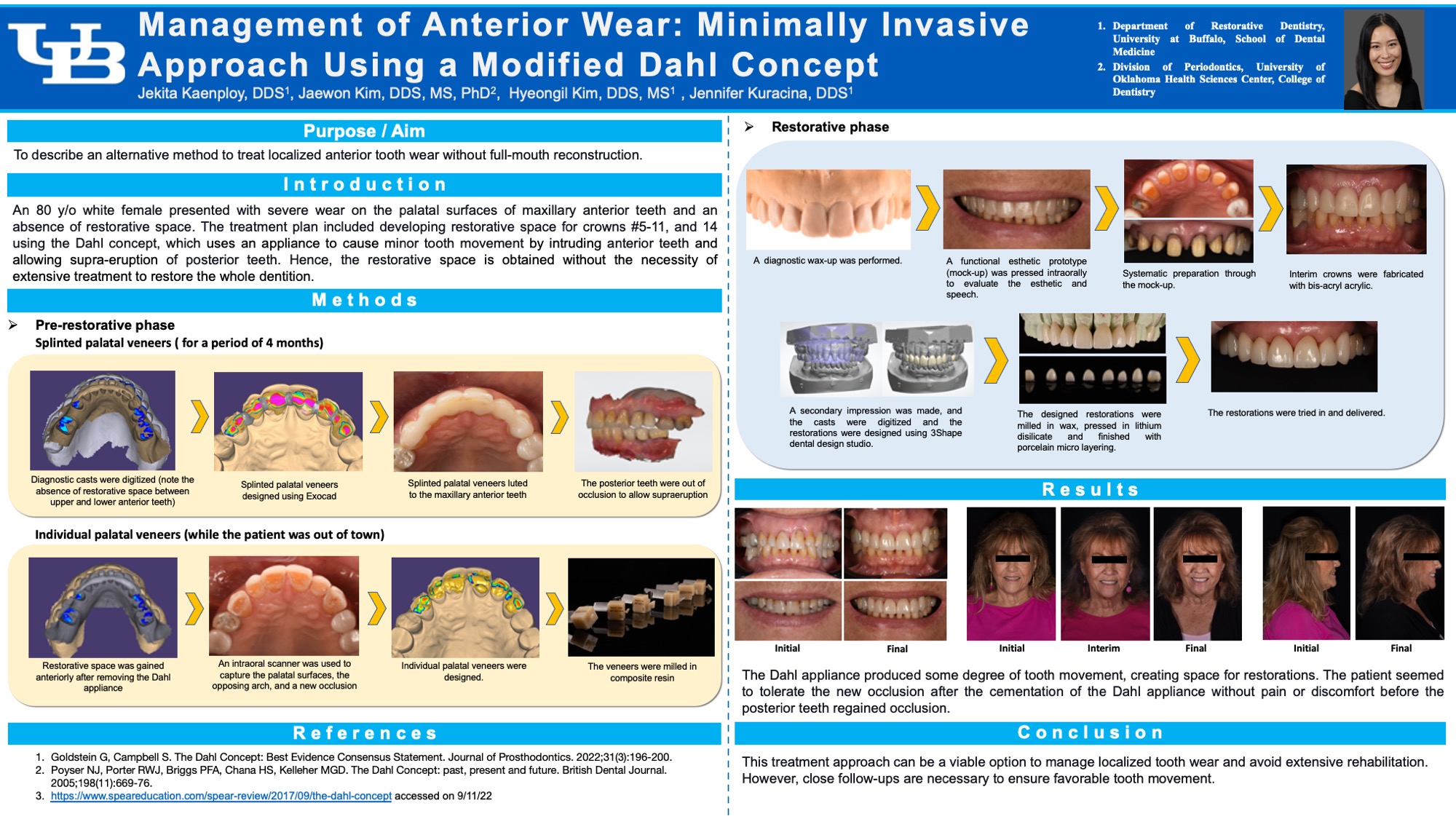48. Management of Anterior Wear Minimally Invasive Approach Using a